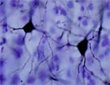 Golgi Neuron Cortex