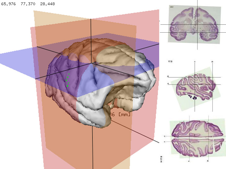 BRAINMAPS ORG BRAIN ATLAS BRAIN MAPS BRAIN STRUCTURE 